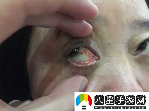 獲得超級(jí)胬肉系統(tǒng)小說第二部