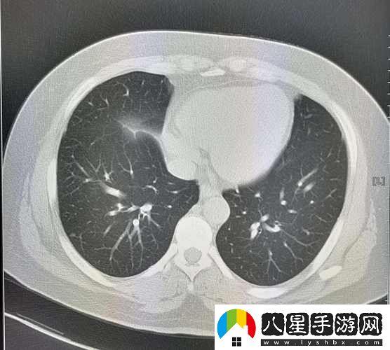 男配每天都在體內(nèi)成結(jié)節(jié)