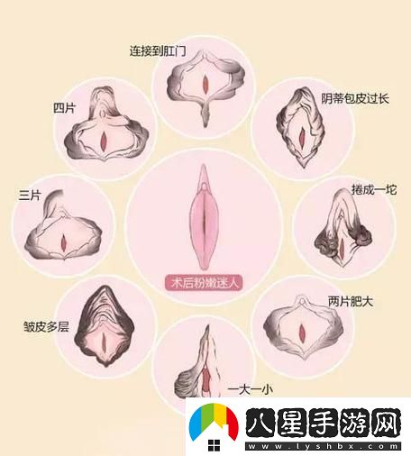 探討女人私密肥大