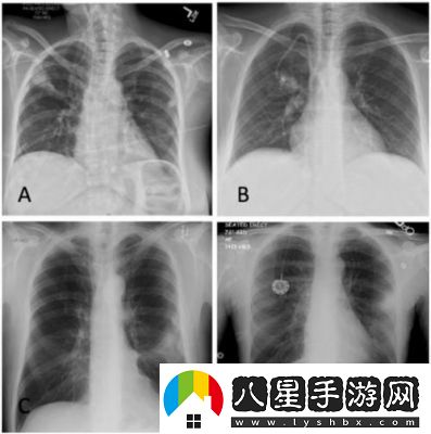 新手必備天天忍者攻略及軍團(tuán)爭霸詳解
